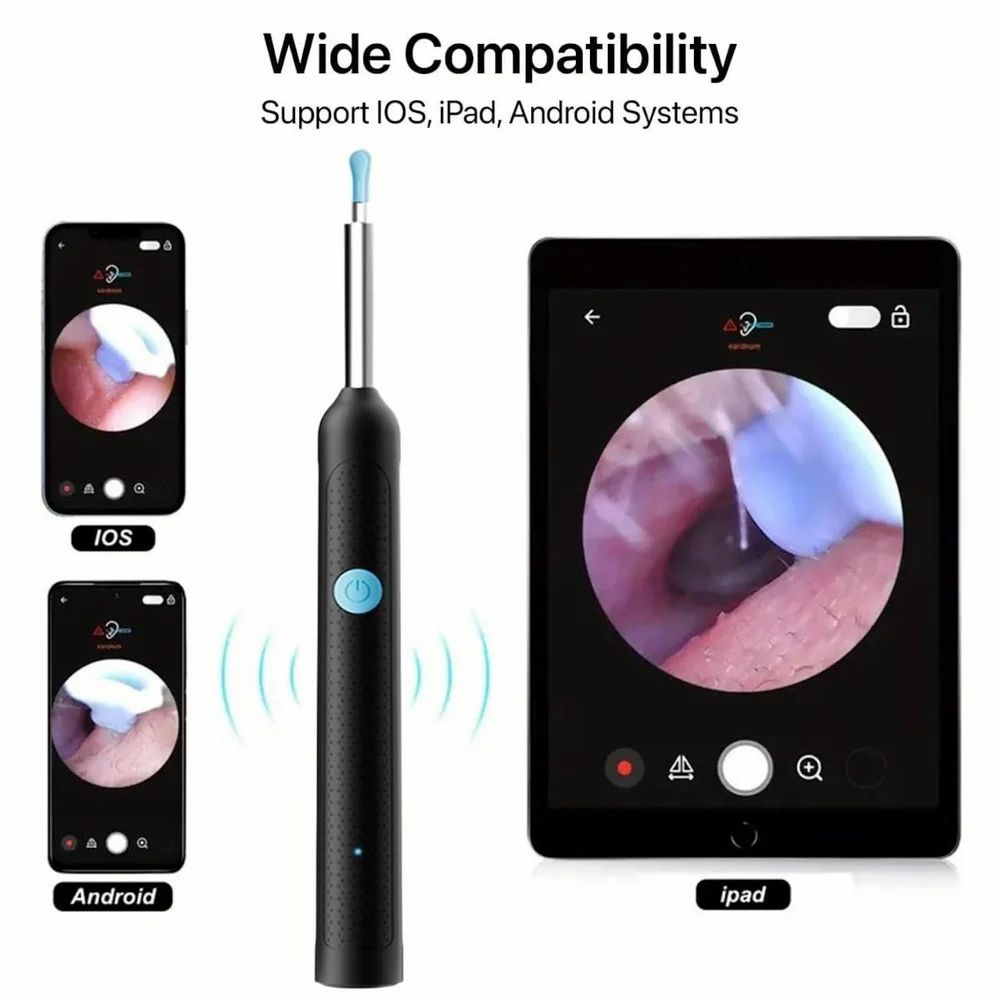 Smart Wax Cleaner with 1080p FHD camera 4.5mm Lens — Safe for Kids and Adults
